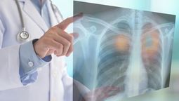 altText(Fumar daña los genes que pueden prevenir el cáncer)}