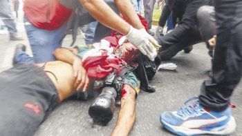 Entre los heridos en esta represión está el fotoperiodista Pablo Grillo.
