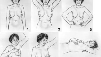 ¿Cómo realizarse un autotest mamario?