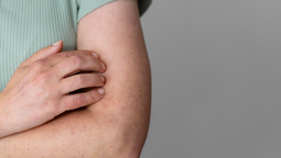 altText(Sarampión: MSP confirmó aparición del primer caso autóctono)}