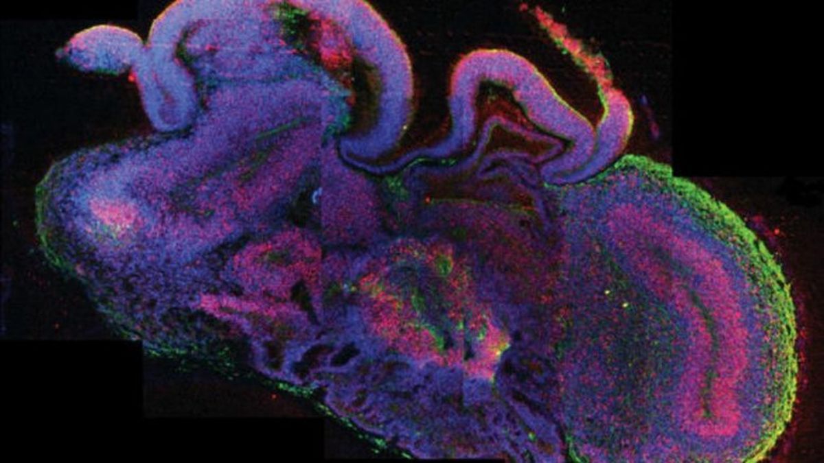 Infectarán mini-cerebros con zika virus para investigación
