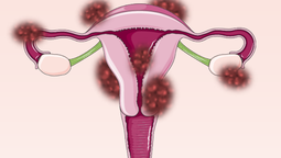 altText(Día Mundial de la Endometriosis)}