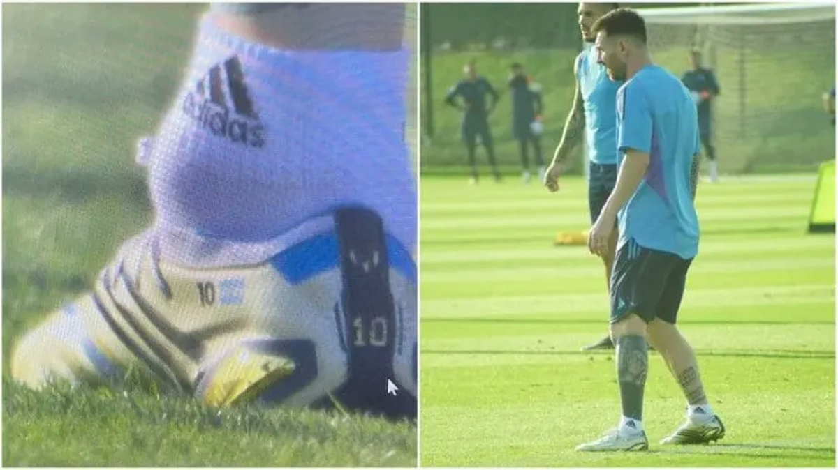 La imagen del tobillo de Messi recorre el mundo.