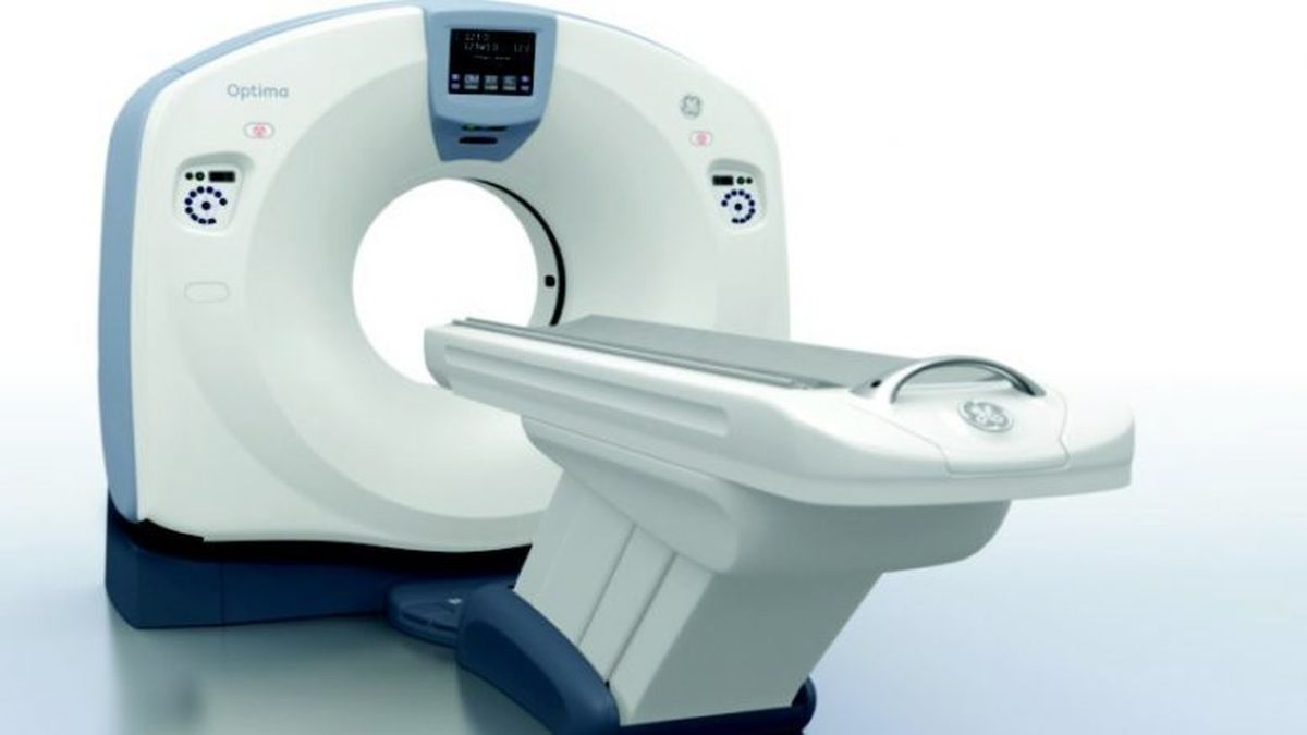 Score de calcio Un estudio para conocer el riesgo de sufrir un infarto