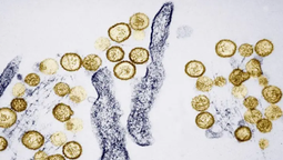 Hantavirus
