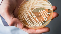 altText(Un hongo mortal de origen desconocido amenaza a la humanidad)}