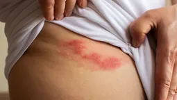 altText(Preocupación y aislamiento por foco de varicela en la cárcel de Canelones)}