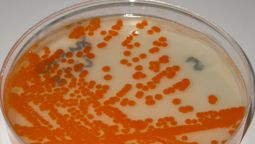 altText(Investigan la Fake News del estreptococo en el agua de OSE)}