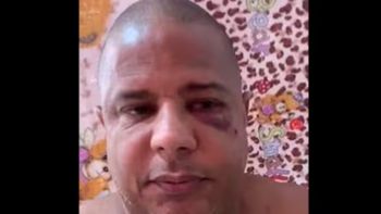 Marcelinho Carioca fue secuestrado por pata de bolsa