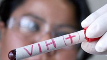 Test de VIH sin costo y sin orden médica: jornada abierta en la Intendencia