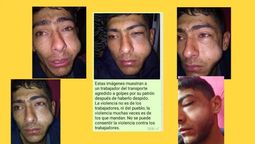 altText(Brutal agresión a trabajador del SUTCRA)}