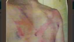 altText(Trabajador rural golpeado con rebenque y víctima del poder político)}